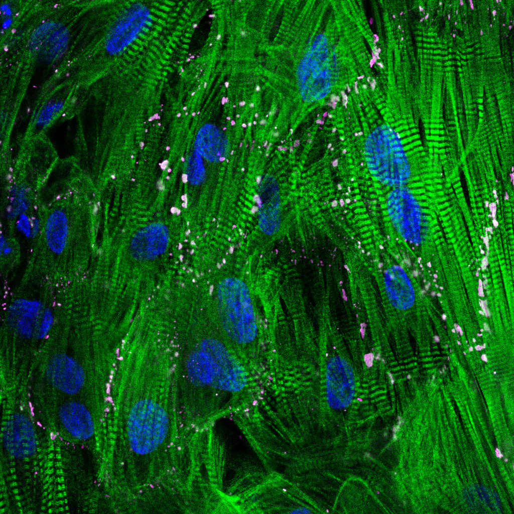 Cardiac R2U Assay